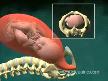 Do�um video